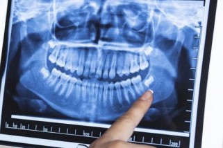 Фото: Будут ли в Лиде делать 3D-снимок зубов?