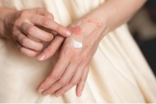 Фото: Псориаз: психоэмоциональная составляющая болезни